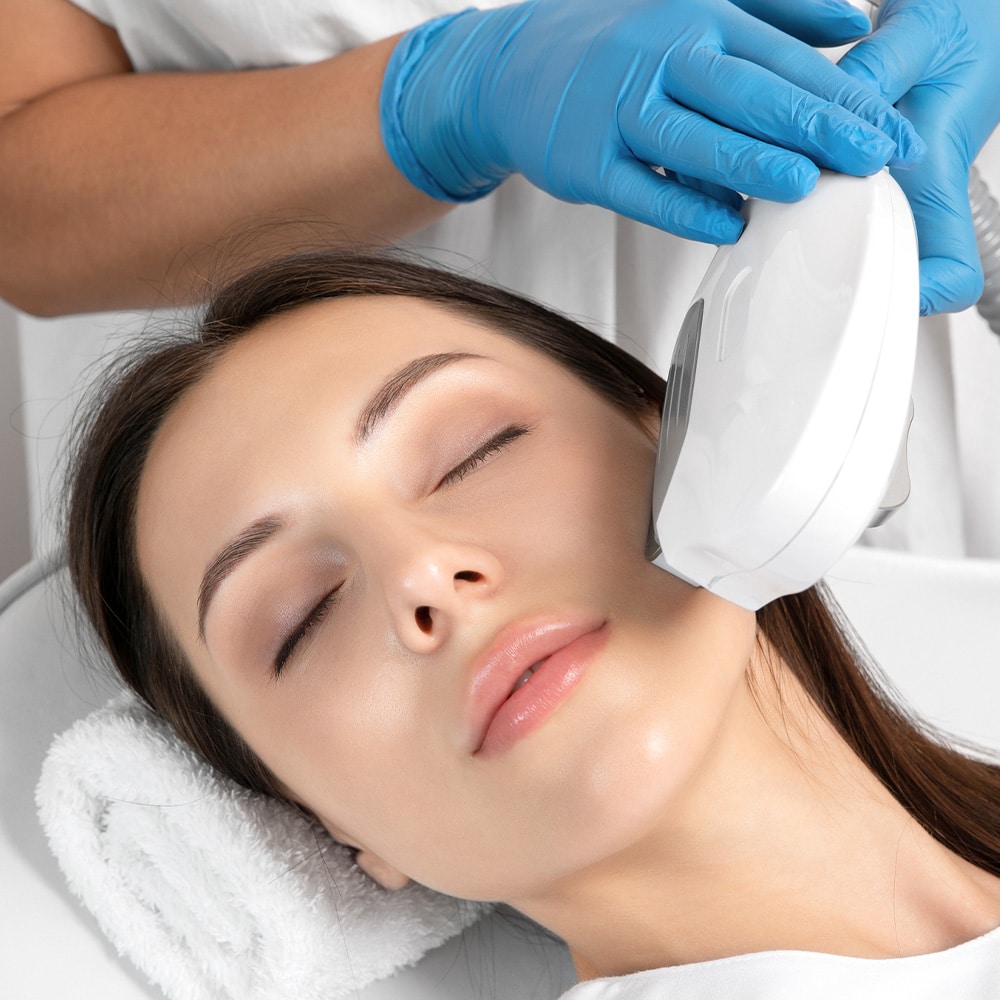 Photofacials Flowood MS Sculpt Aesthetics Wellness